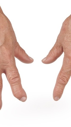 手掌颜色暗含大秘密，疾病种类一看就知道？